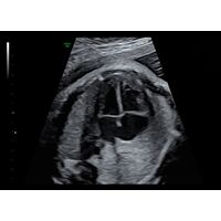GE Healthcare Voluson E6 УЗИ аппарат стационарный — фото 13