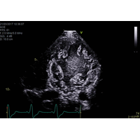 GE Healthcare Vivid E90 УЗИ аппарат стационарный — фото 12