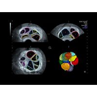 GE Healthcare Voluson E8 УЗИ аппарат стационарный — фото 16