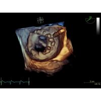 GE Healthcare Vivid S70 УЗИ аппарат стационарный — фото 2