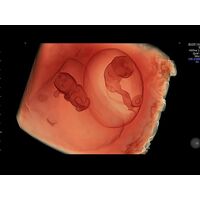 GE Healthcare Voluson E8 УЗИ аппарат стационарный — фото 2
