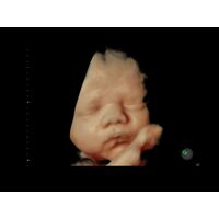 GE Healthcare Voluson E8 УЗИ аппарат стационарный — фото 3
