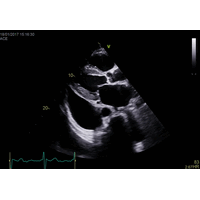 GE Healthcare Vivid E90 УЗИ аппарат стационарный — фото 3