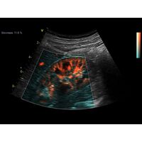 GE Healthcare Vivid S70 УЗИ аппарат стационарный — фото 4
