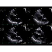 GE Healthcare Vivid S60 УЗИ аппарат стационарный — фото 5
