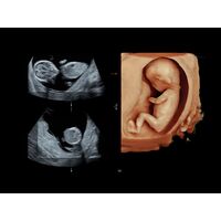 GE Healthcare Voluson E8 УЗИ аппарат стационарный — фото 6
