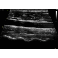 GE Healthcare Vivid E90 УЗИ аппарат стационарный — фото 6