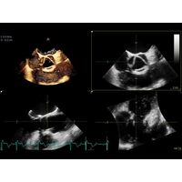 GE Healthcare Vivid S70 УЗИ аппарат стационарный — фото 6