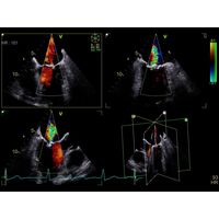 GE Healthcare Vivid S70 УЗИ аппарат стационарный — фото 8