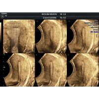 GE Healthcare Voluson P8 УЗИ аппарат стационарный — фото 11