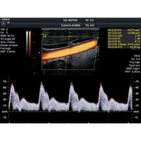 GE Healthcare Voluson P8 УЗИ аппарат стационарный — фото 5