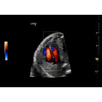 GE Healthcare Logiq F8 УЗИ аппарат стационарный — фото 8