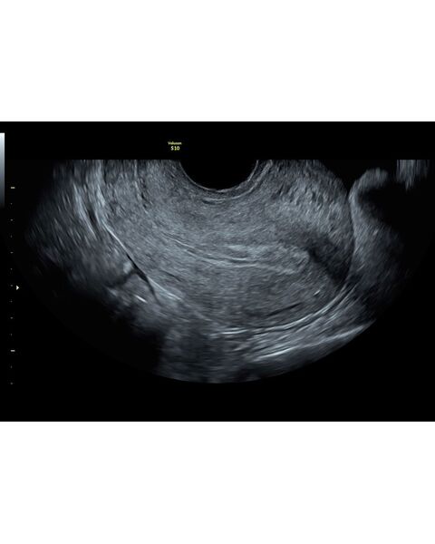 GE Healthcare Voluson S10 УЗИ аппарат стационарный — фото 11