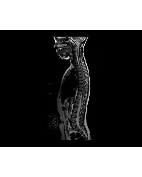 GE Healthcare SIGNA PET/MR — фото 11