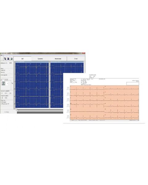 Cardioline cubeecg Программное обеспечение для работы на персональном компьютере — фото 1