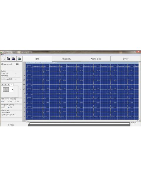 Cardioline cubeecg Программное обеспечение для работы на персональном компьютере — фото 2