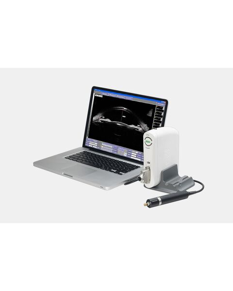 Suoer SW-3200 Ультразвуковой сканер с UBM-датчиком — фото 1